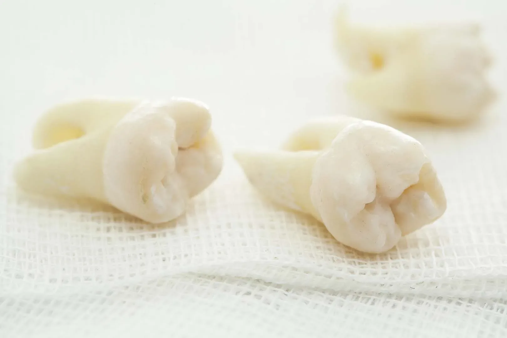 Wisdom teeth removal consultation in Kaysville, UT